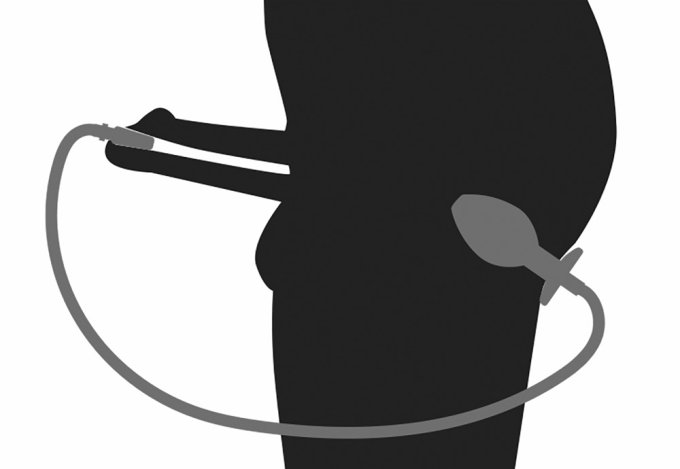 Plug Penis avec plug anal pour jeu Uro